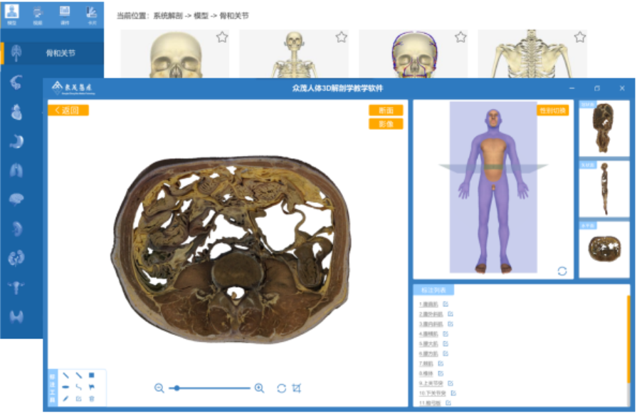 人体3D解剖学教学软件-Q医疗·信息网·医疗信息化平台